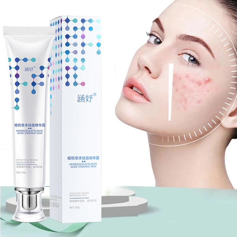Herbal Anti-acne Face Cream