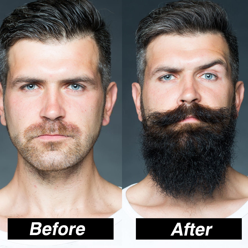Beard Growth Kit/Hair Growth Enhancer/Thicker Beard (4 PC)
